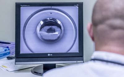 Stroke Behandlung von Schlaganfällen