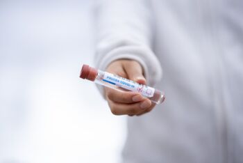 Long Covid, PostVac oder ME/CFS-Diagnose